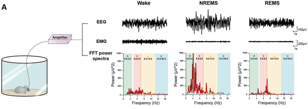 Pinnacle | 大小鼠睡眠研究的金标准——EEG/EMG采集与分析，“一站式”睡眠研究解决方案